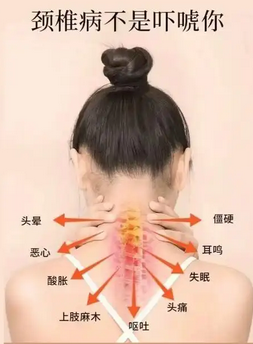 久坐办公室怎么保护颈椎，每天 5