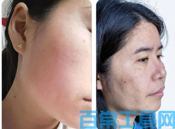 晨起水肿脸肿腿肿 快速消肿去虚胖